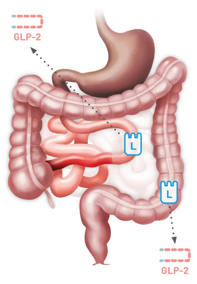 JEJUNOILEAL ANASTOMOSIS