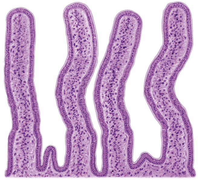 A biopsy of villi