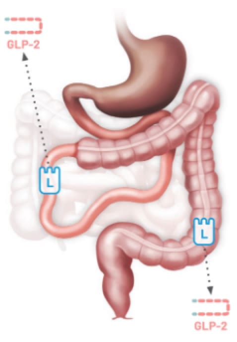 Illustration showing the GLP-2 pathway in a type 2 jejunocolonic anastomosis. The image highlights GLP-2 movement through the small intestine and colon.
